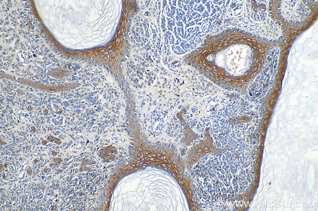 Claudin 1 Antibody in Immunohistochemistry (Paraffin) (IHC (P))