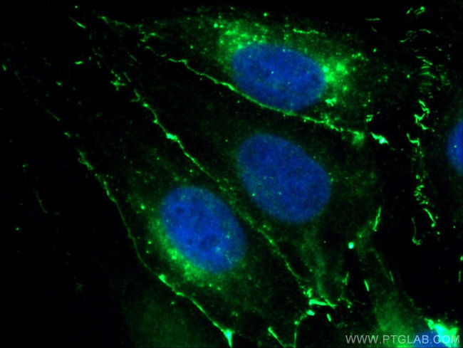 Claudin 1 Antibody in Immunocytochemistry (ICC/IF)