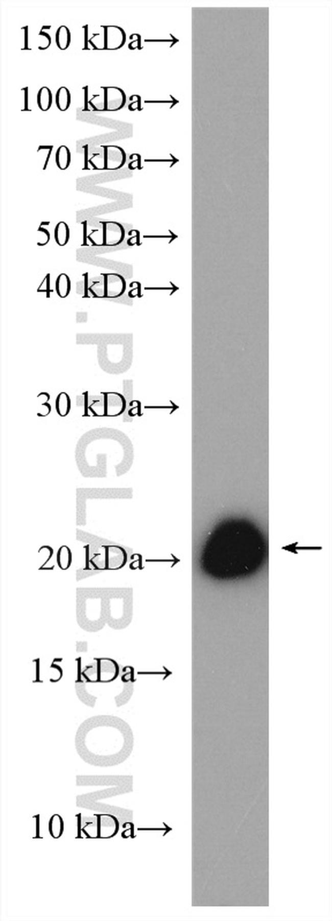 Claudin 1 Antibody in Western Blot (WB)