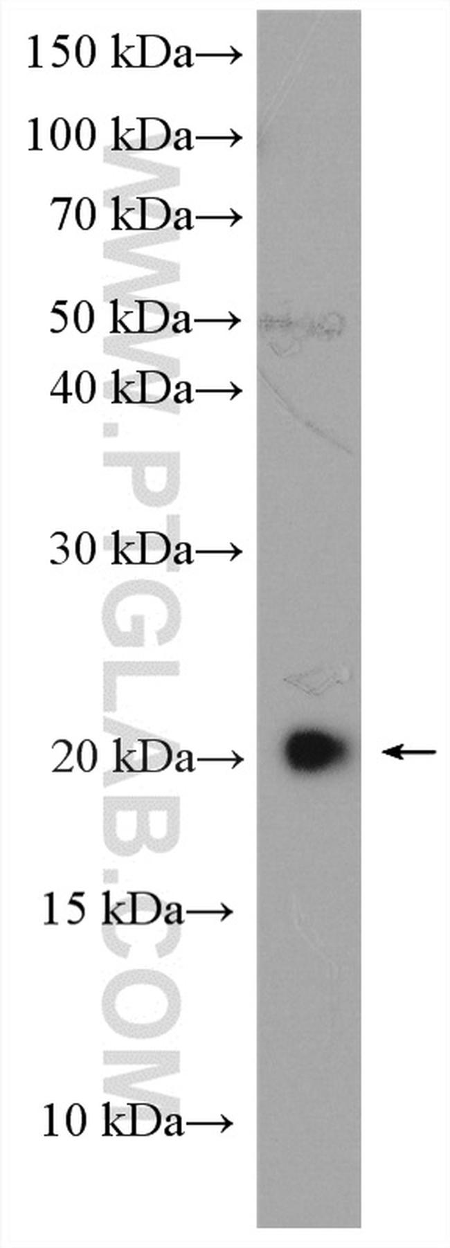 Claudin 1 Antibody in Western Blot (WB)