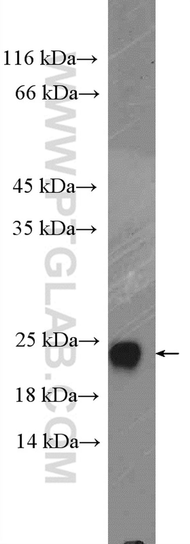 Claudin 1 Antibody in Western Blot (WB)