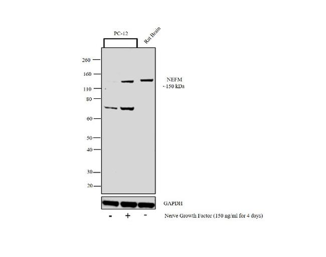 NEFM Antibody in Western Blot (WB)