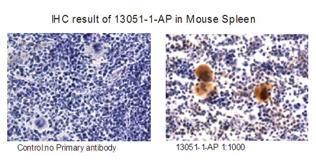 RAB37 Antibody in Immunohistochemistry (IHC)