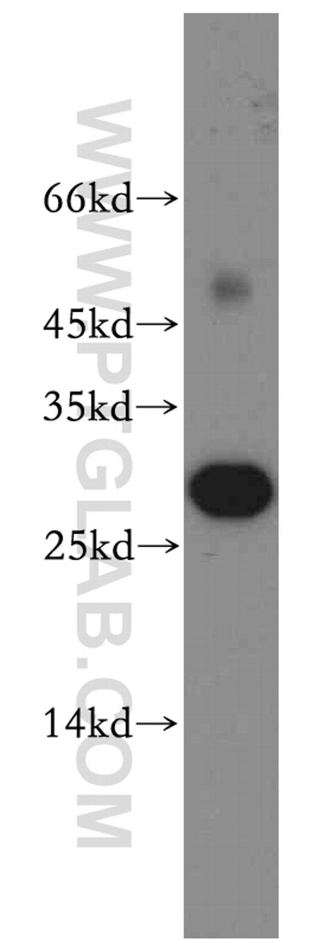 ASPRV1 Antibody in Western Blot (WB)