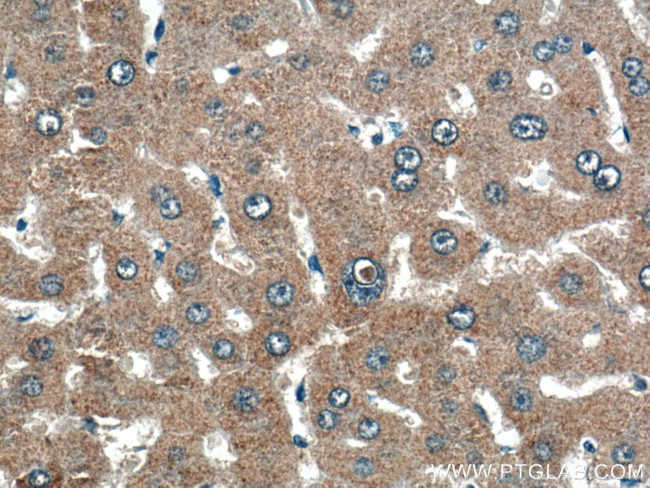 THRSP Antibody in Immunohistochemistry (Paraffin) (IHC (P))