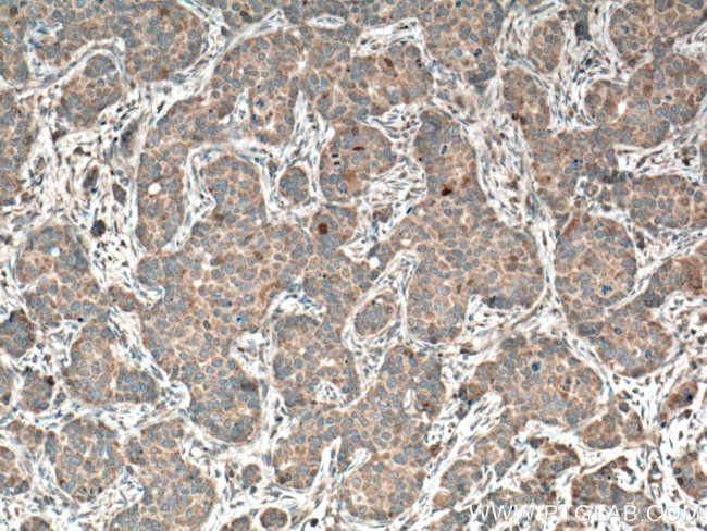 THRSP Antibody in Immunohistochemistry (Paraffin) (IHC (P))