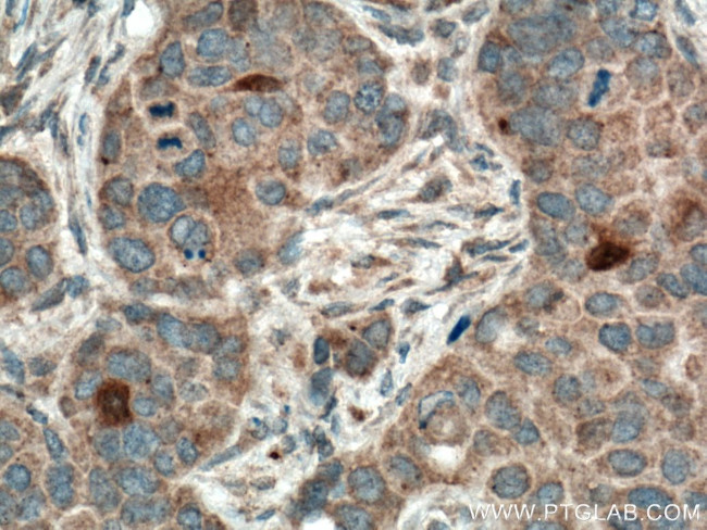 THRSP Antibody in Immunohistochemistry (Paraffin) (IHC (P))