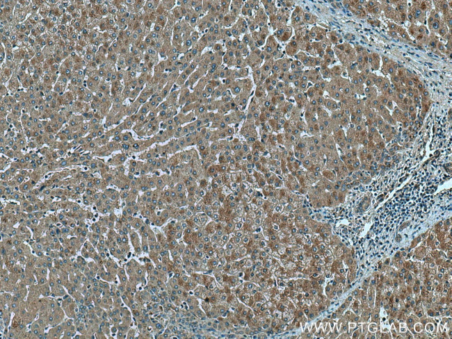 THRSP Antibody in Immunohistochemistry (Paraffin) (IHC (P))