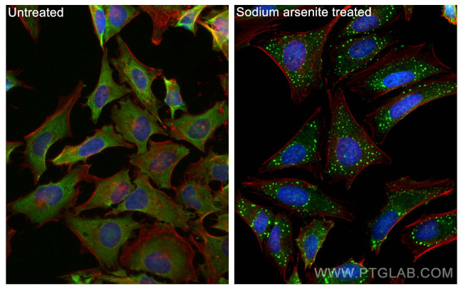 G3BP1 Antibody in Immunocytochemistry (ICC/IF)