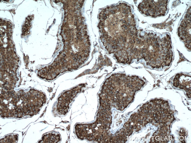 G3BP1 Antibody in Immunohistochemistry (Paraffin) (IHC (P))