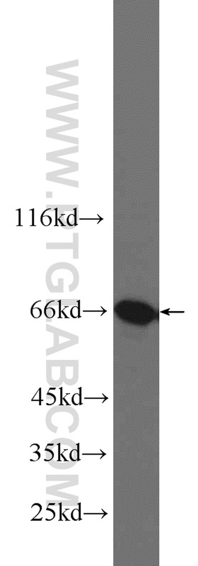 G3BP1 Antibody in Western Blot (WB)