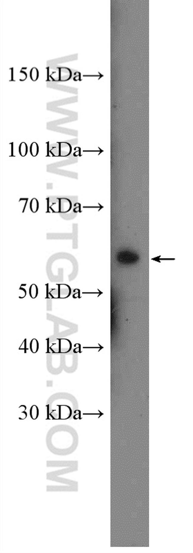 G3BP1 Antibody in Western Blot (WB)