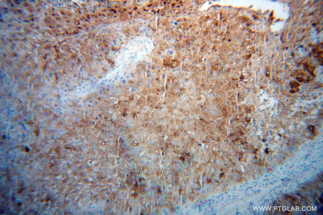 CALML5 Antibody in Immunohistochemistry (Paraffin) (IHC (P))