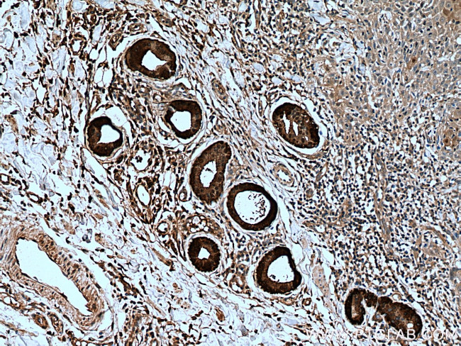 CALML5 Antibody in Immunohistochemistry (Paraffin) (IHC (P))