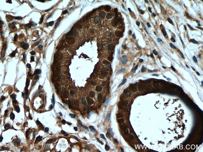 CALML5 Antibody in Immunohistochemistry (Paraffin) (IHC (P))