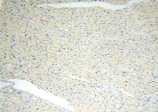 CDK2AP1 Antibody in Immunohistochemistry (Paraffin) (IHC (P))