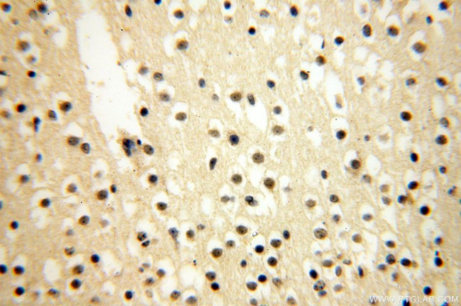 CDK2AP1 Antibody in Immunohistochemistry (Paraffin) (IHC (P))