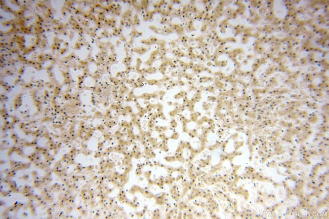 CDK2AP1 Antibody in Immunohistochemistry (Paraffin) (IHC (P))