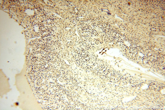 CDK2AP1 Antibody in Immunohistochemistry (Paraffin) (IHC (P))