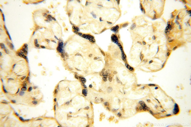 CDK2AP1 Antibody in Immunohistochemistry (Paraffin) (IHC (P))