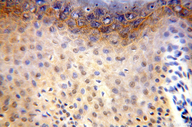 CDK2AP1 Antibody in Immunohistochemistry (Paraffin) (IHC (P))