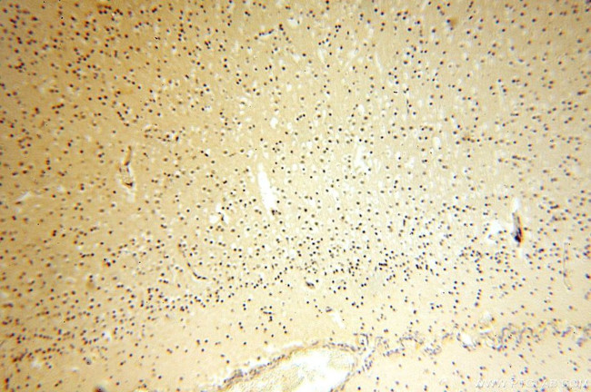 CDK2AP1 Antibody in Immunohistochemistry (Paraffin) (IHC (P))