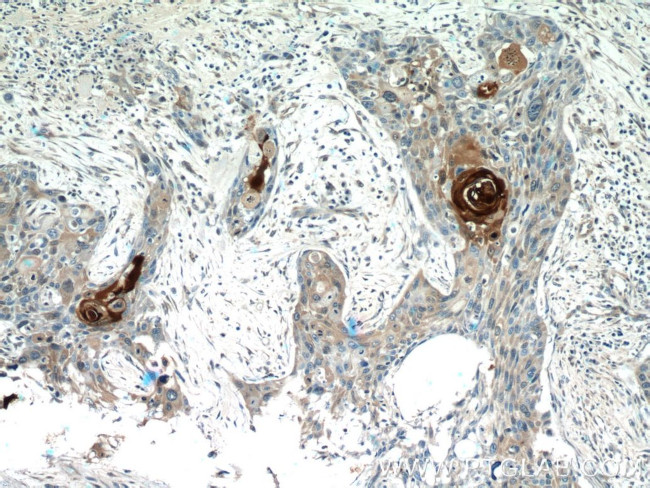 S100A7/Psoriasin Antibody in Immunohistochemistry (Paraffin) (IHC (P))