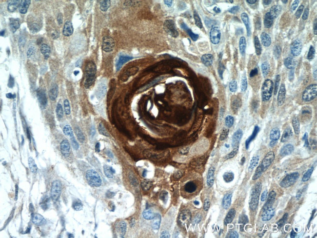 S100A7/Psoriasin Antibody in Immunohistochemistry (Paraffin) (IHC (P))