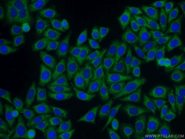 SAMSN1 Antibody in Immunocytochemistry (ICC/IF)