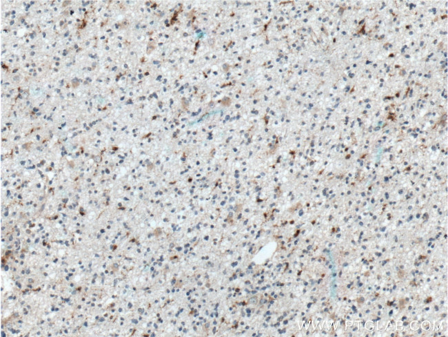 SAMSN1 Antibody in Immunohistochemistry (Paraffin) (IHC (P))