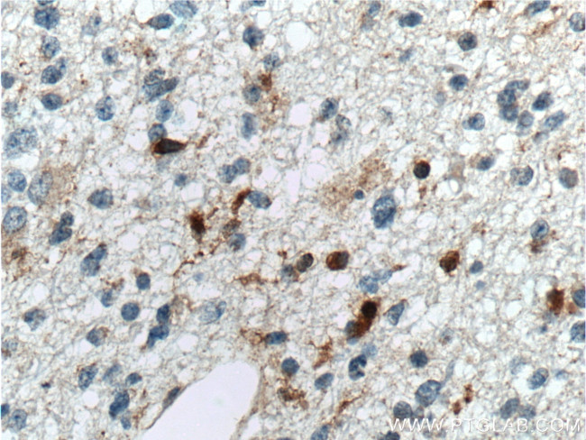 SAMSN1 Antibody in Immunohistochemistry (Paraffin) (IHC (P))