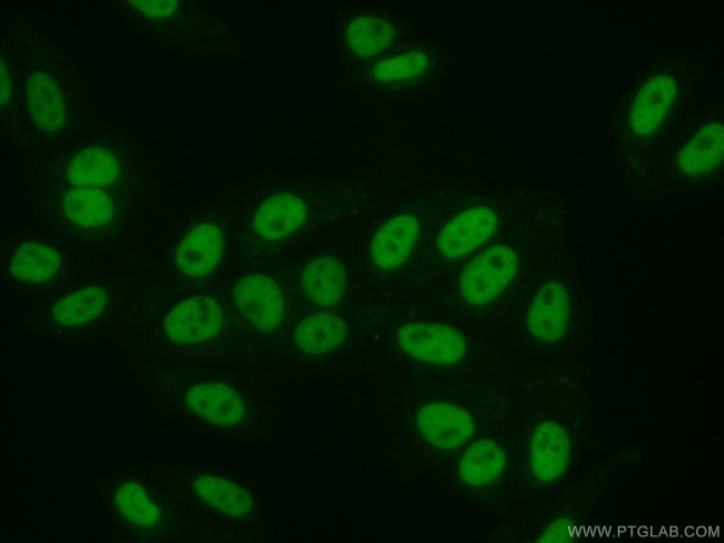 SMARCA5 Antibody in Immunocytochemistry (ICC/IF)