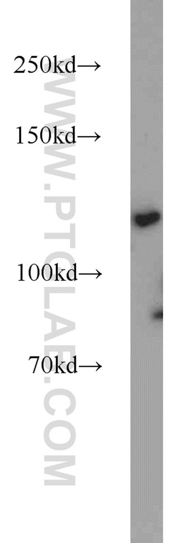 SMARCA5 Antibody in Western Blot (WB)