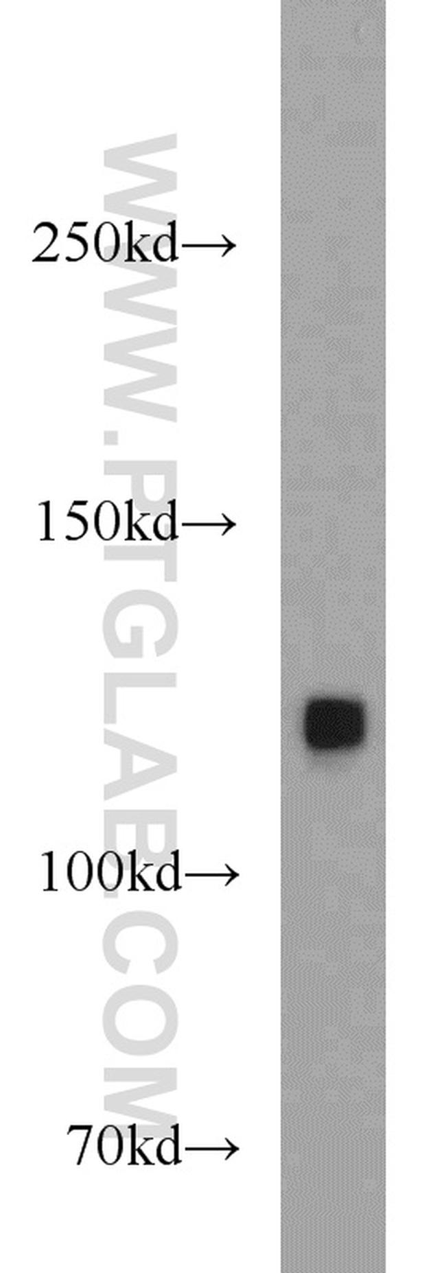 SMARCA5 Antibody in Western Blot (WB)