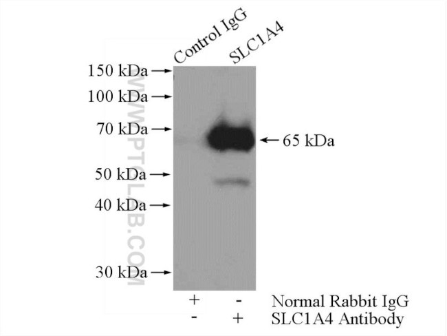 SLC1A4 Antibody in Immunoprecipitation (IP)