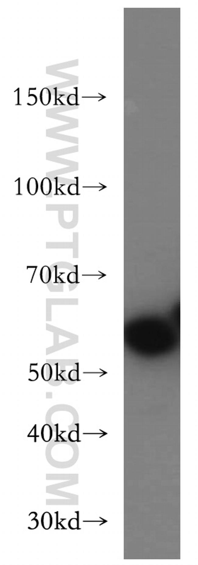 SLC1A4 Antibody in Western Blot (WB)