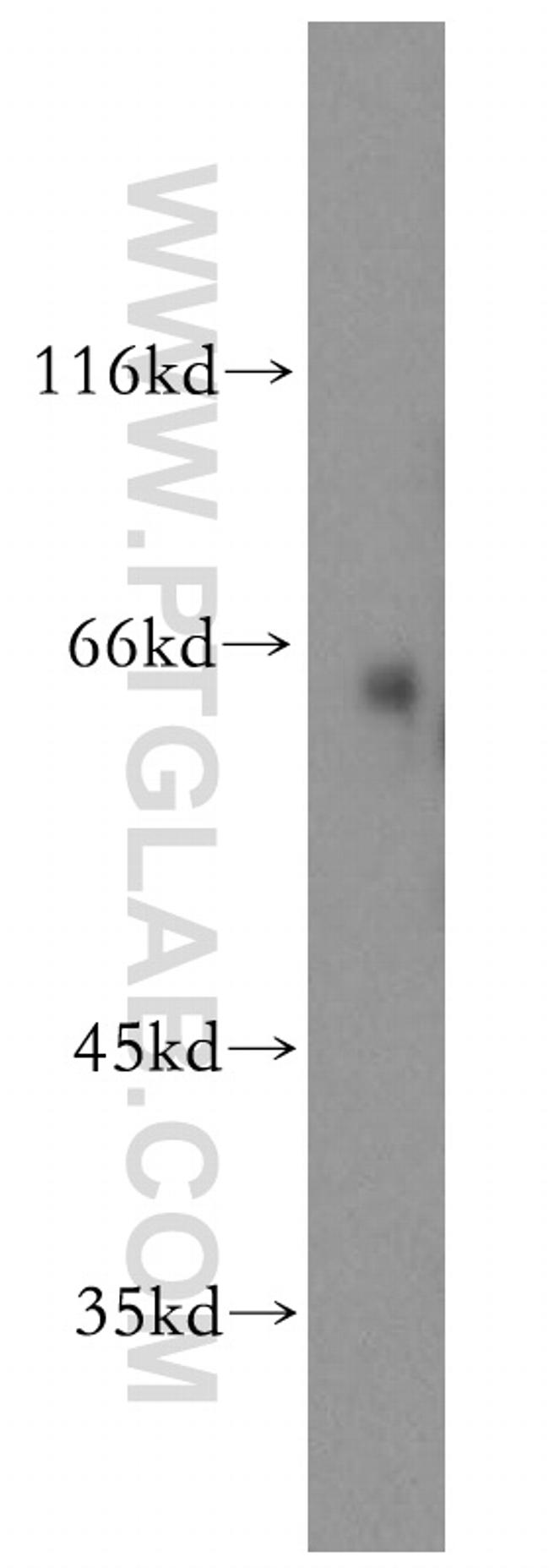 SLC1A4 Antibody in Western Blot (WB)