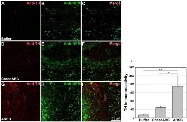 NEFM Antibody in Immunohistochemistry (IHC)