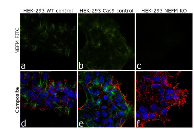 NEFM Antibody in Immunocytochemistry (ICC/IF)