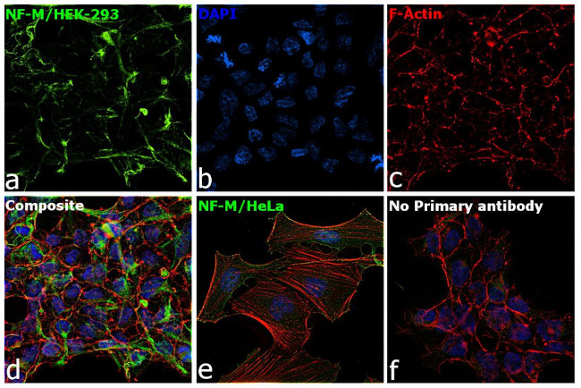 NEFM Antibody in Immunocytochemistry (ICC/IF)