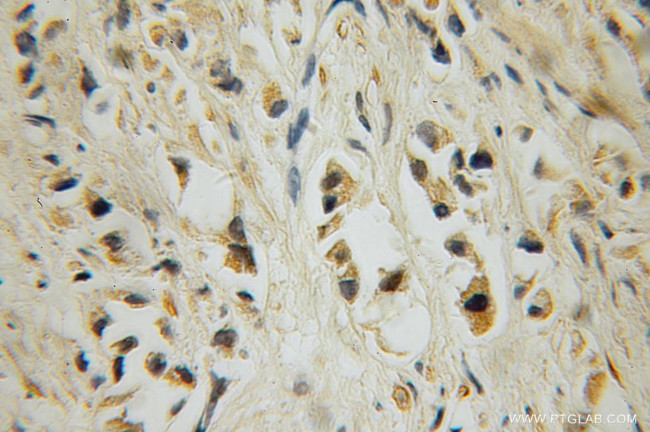 15 Lipoxygenase 2 Antibody in Immunohistochemistry (Paraffin) (IHC (P))