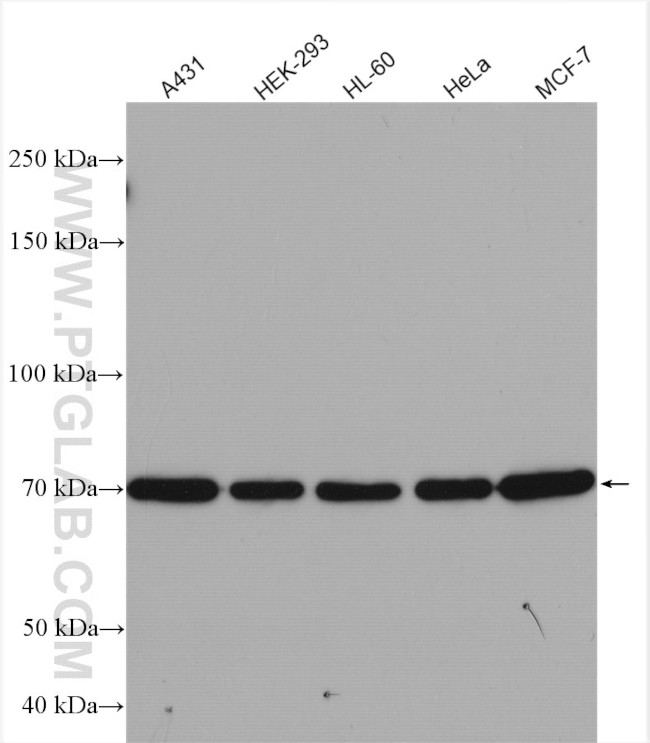 15 Lipoxygenase 2 Antibody in Western Blot (WB)