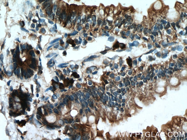 DFNA5 Antibody in Immunohistochemistry (Paraffin) (IHC (P))