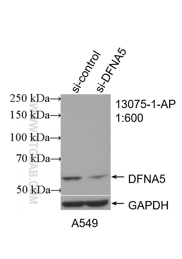 DFNA5 Antibody in Western Blot (WB)