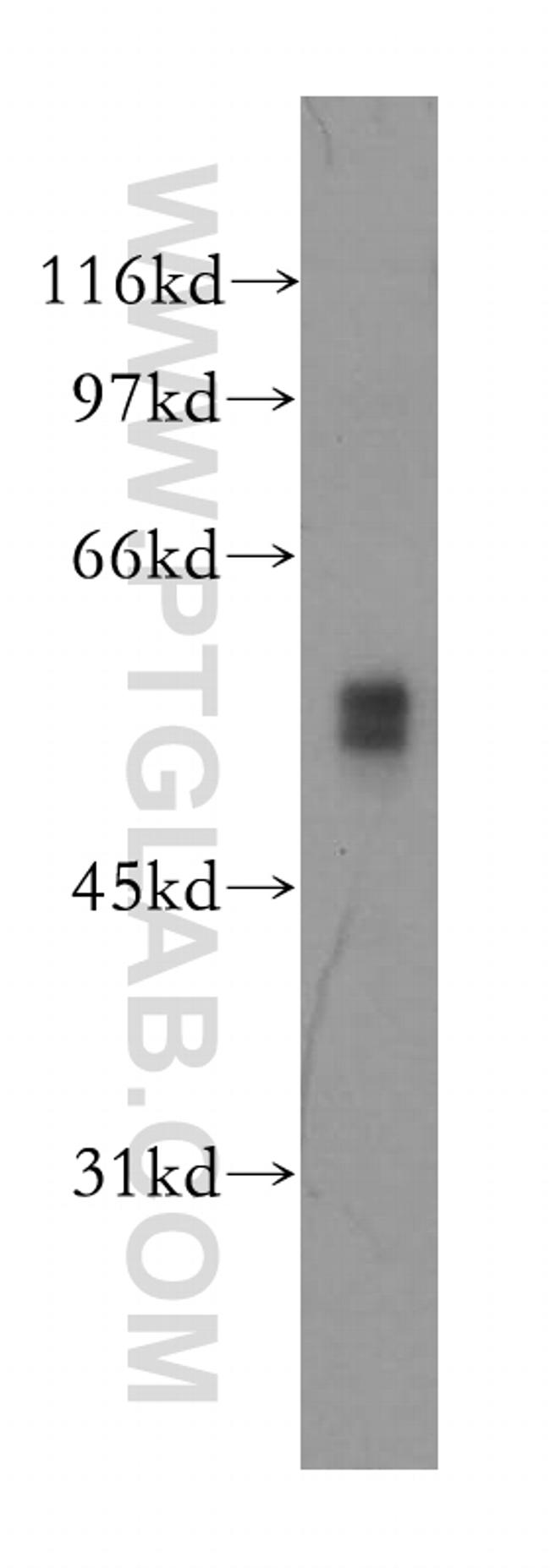 DFNA5 Antibody in Western Blot (WB)