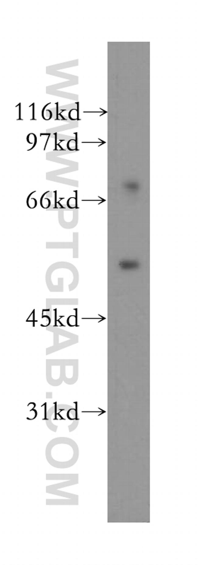 DFNA5 Antibody in Western Blot (WB)