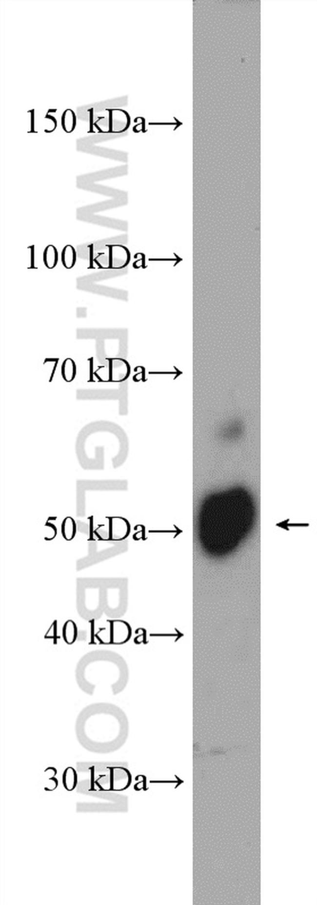 DFNA5 Antibody in Western Blot (WB)