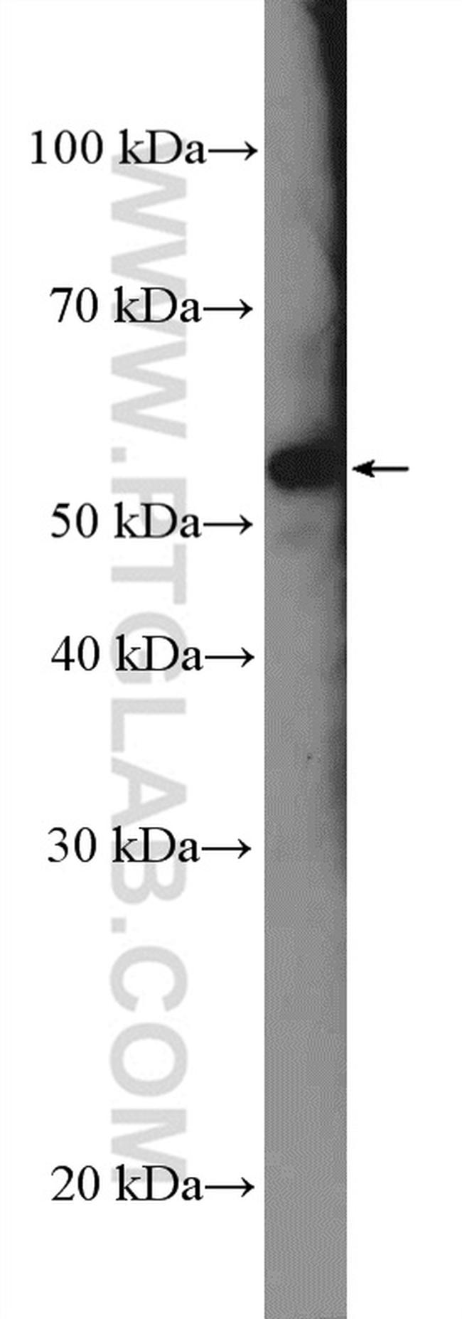 DFNA5 Antibody in Western Blot (WB)