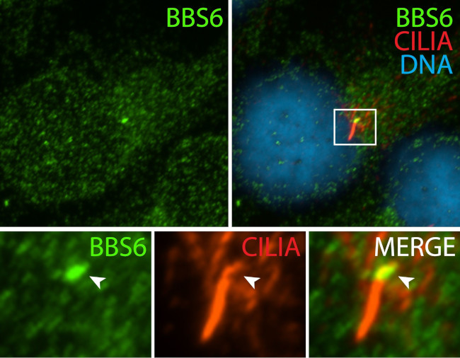 BBS6 Antibody in Immunocytochemistry (ICC/IF)