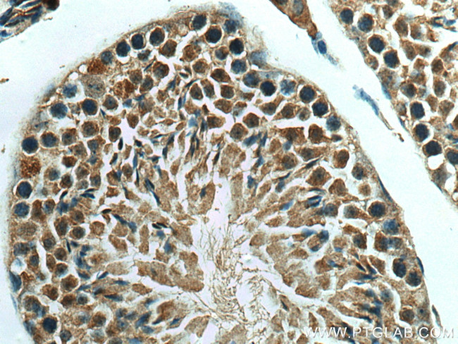 BBS6 Antibody in Immunohistochemistry (Paraffin) (IHC (P))